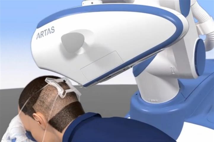 ARTAS-robotic-hair-restoration