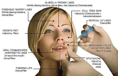 how much does face slimming botox cost