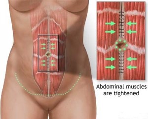 full-abdominoplasty