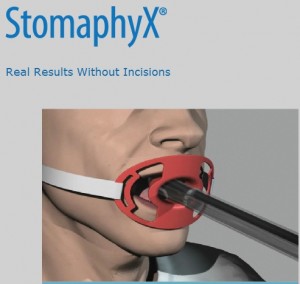 StomaphyX