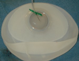 tissue-expander-saline-breast-implant