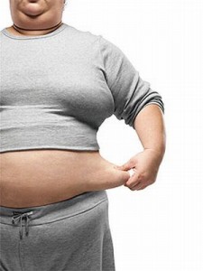 obesity-surgery