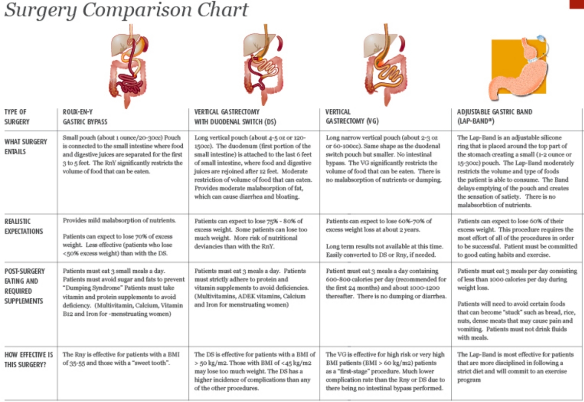 Gastric Sleeve Average Weight Loss Chart